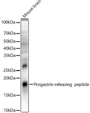 Progastrin-releasing  peptide Rabbit pAb