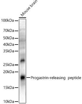 Progastrin-releasing  peptide Rabbit pAb