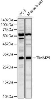 TIMM29 Rabbit pAb