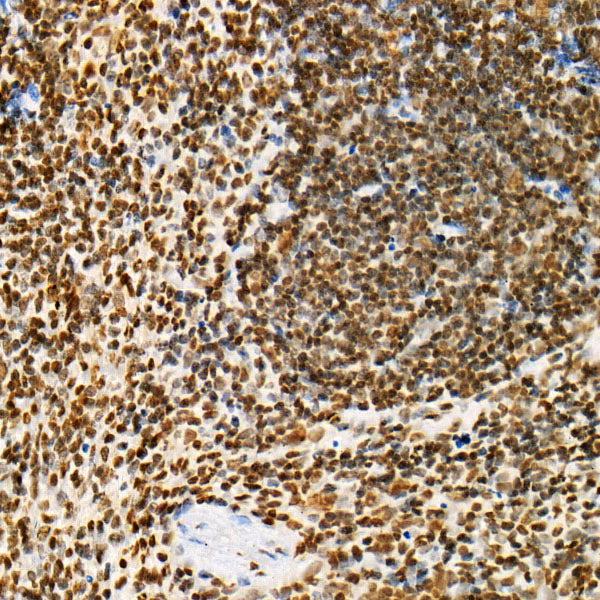 Acetyl-Histone H4-K12 Rabbit mAb