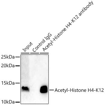 Acetyl-Histone H4-K12 Rabbit mAb
