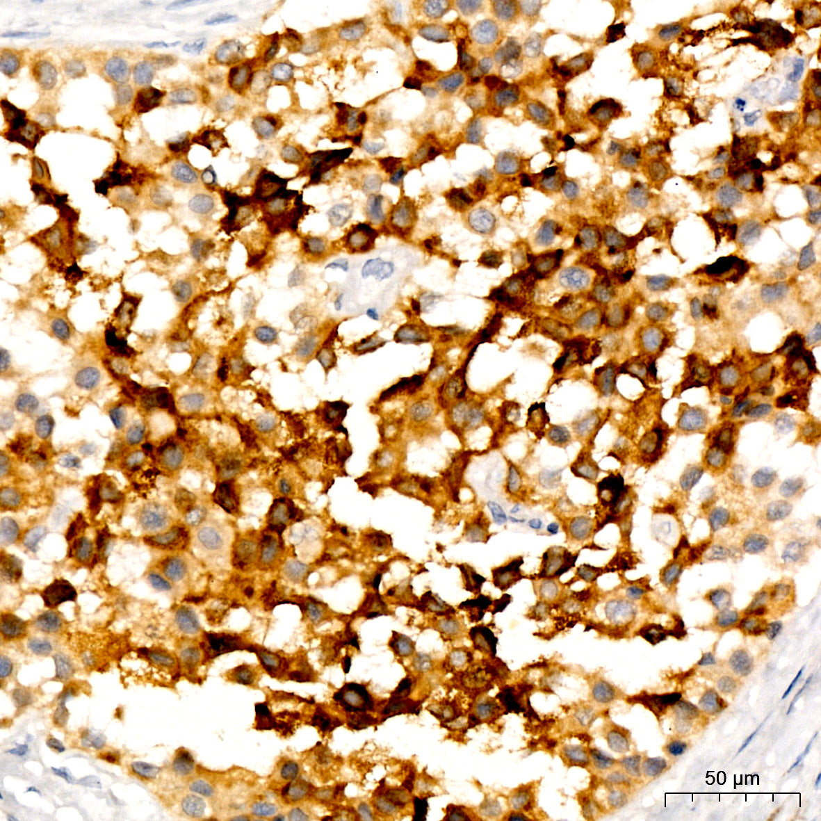 PMEL Rabbit mAb