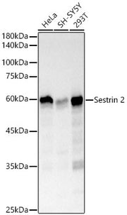 Sestrin 2 Rabbit mAb