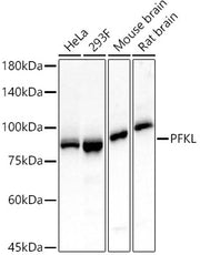 PFKL Rabbit mAb
