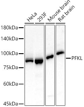 PFKL Rabbit mAb