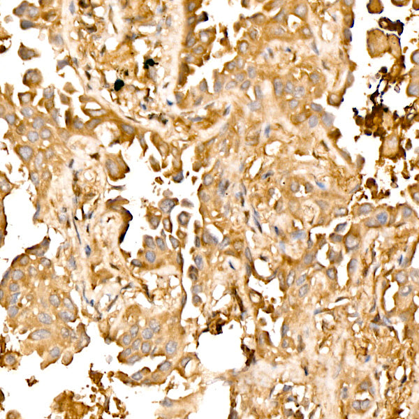 PFKL Rabbit mAb