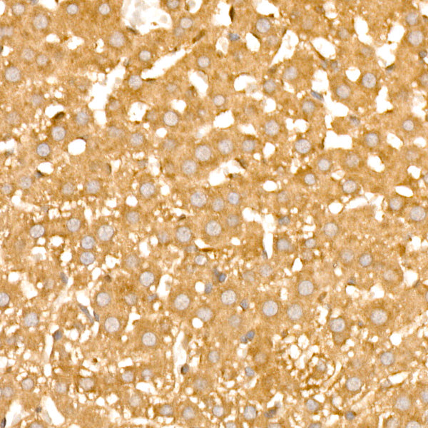 PFKL Rabbit mAb