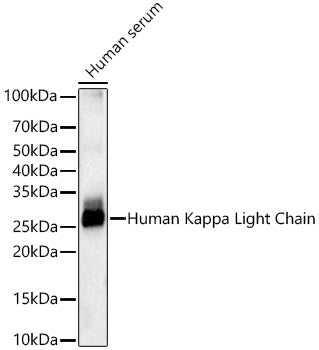 Human Kappa Light Chain Rabbit mAb