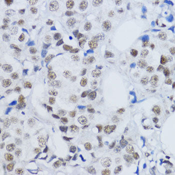 DiMethyl-Histone H3-K79 Rabbit pAb