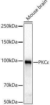 PKCε Rabbit mAb