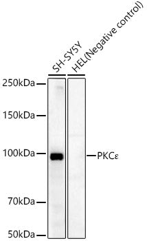 PKCε Rabbit mAb
