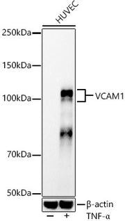 VCAM1 Rabbit mAb