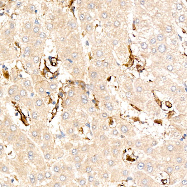 VCAM1 Rabbit mAb