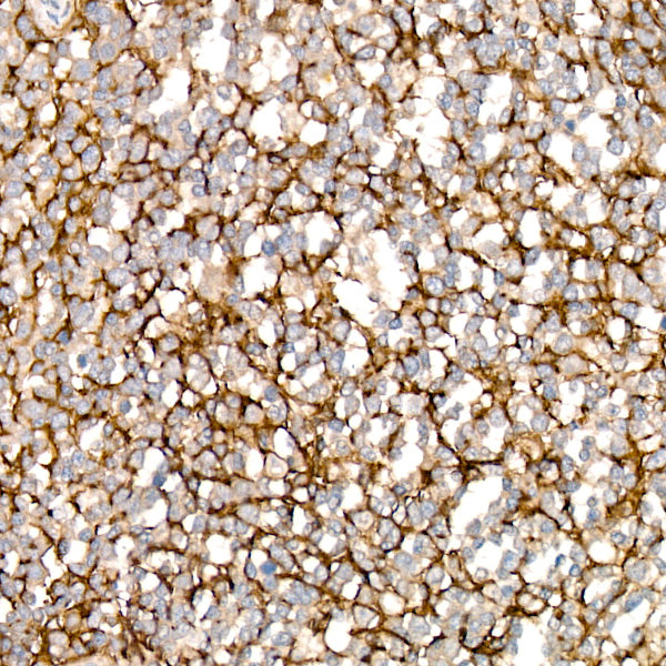 VCAM1 Rabbit mAb