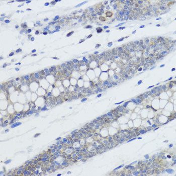 MonoMethyl-Histone H4-K20 Rabbit pAb