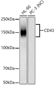 CD43 Rabbit mAb