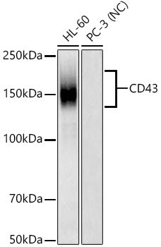 CD43 Rabbit mAb