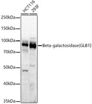 Beta-galactosidase （GLB1）Rabbit mAb