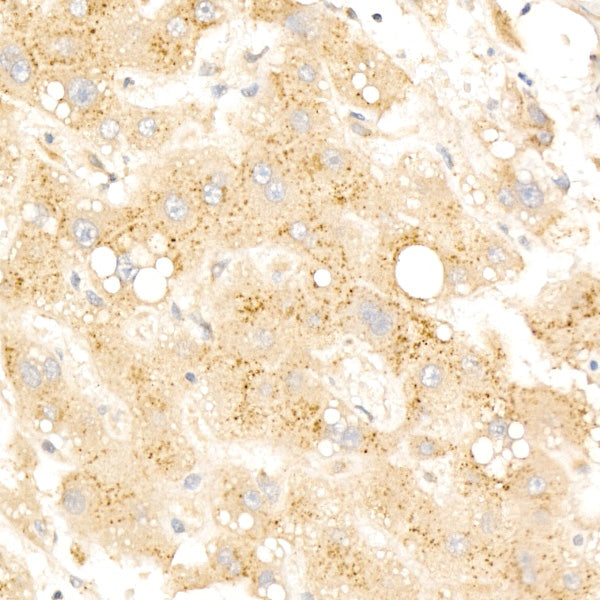Beta-galactosidase （GLB1）Rabbit mAb