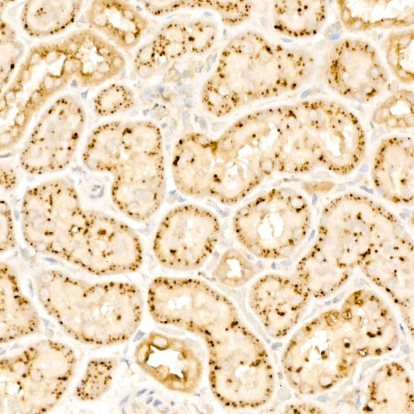 Beta-galactosidase （GLB1）Rabbit mAb