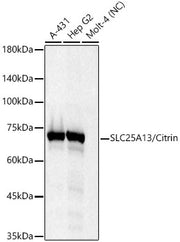 SLC25A13/Citrin Rabbit mAb