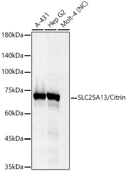 SLC25A13/Citrin Rabbit mAb