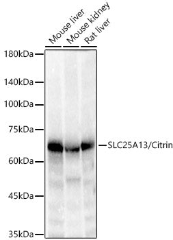 SLC25A13/Citrin Rabbit mAb