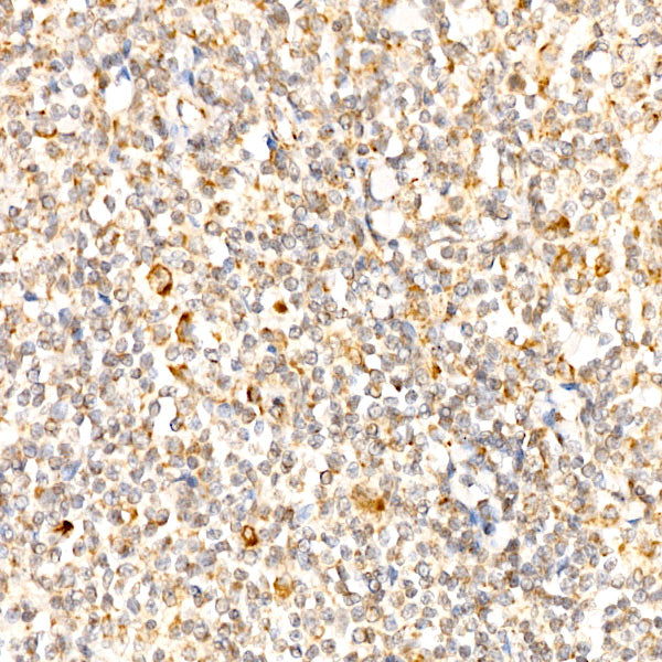 SLC25A13/Citrin Rabbit mAb