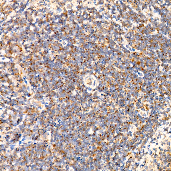 SLC25A13/Citrin Rabbit mAb