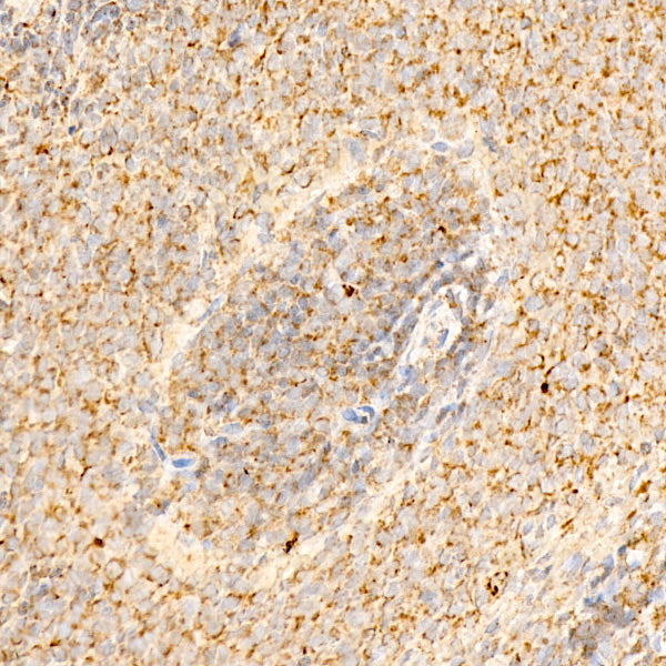 SLC25A13/Citrin Rabbit mAb