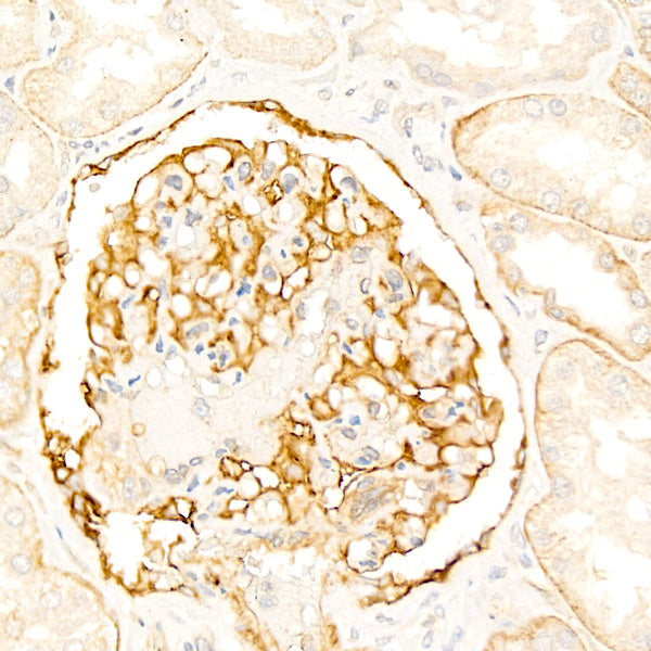 CD239/BCAM Rabbit mAb