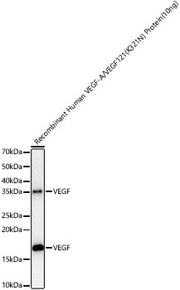 VEGF Rabbit mAb