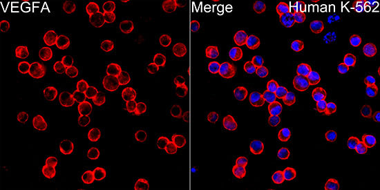 VEGF Rabbit mAb