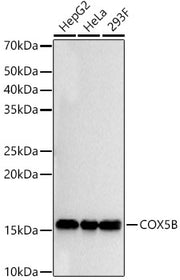 COX5B Rabbit mAb