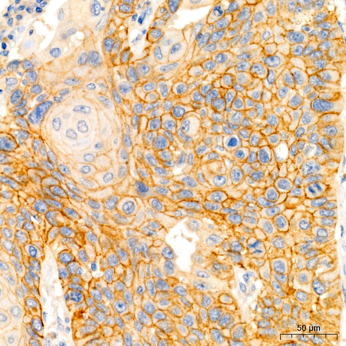 EGFR Rabbit mAb
