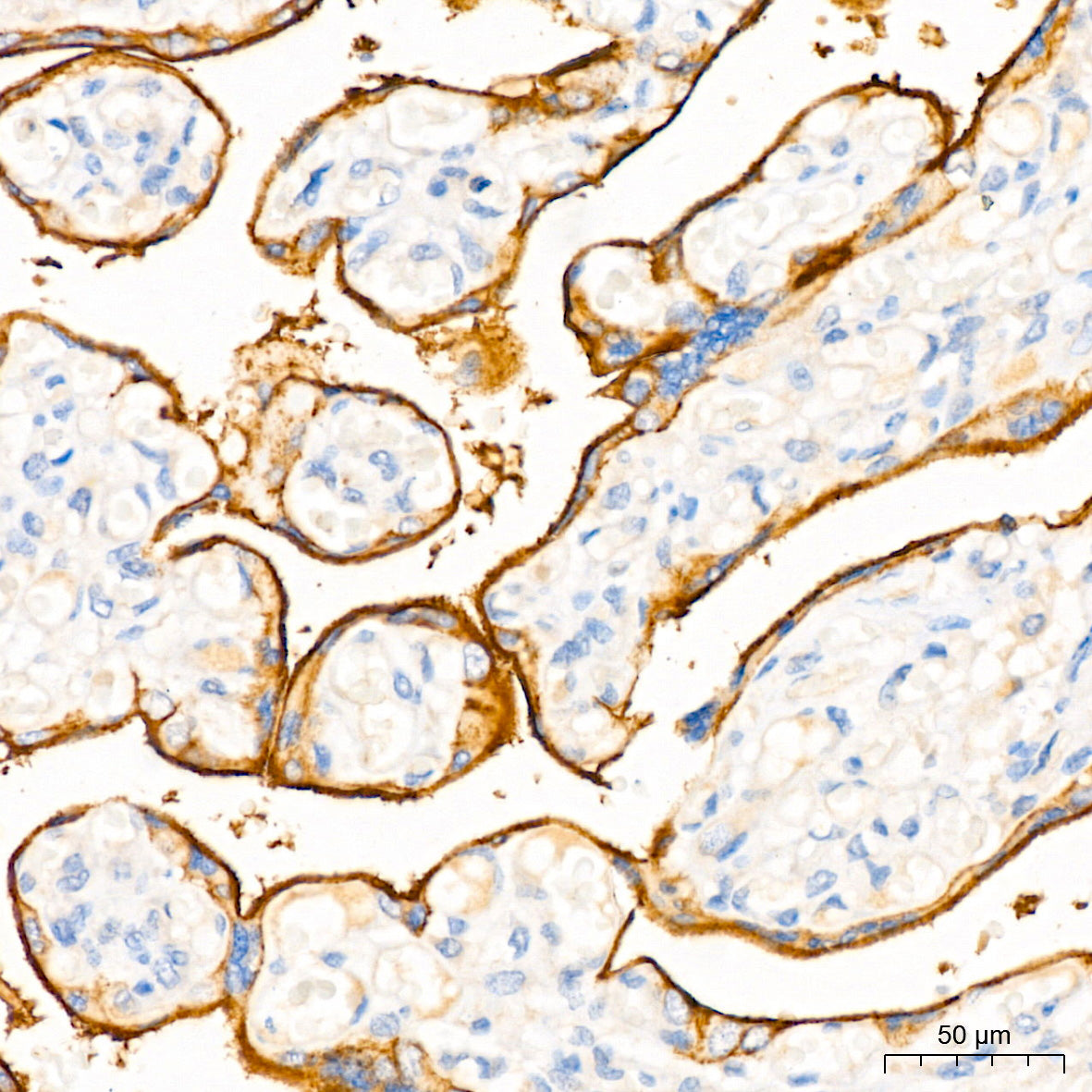 EGFR Rabbit mAb