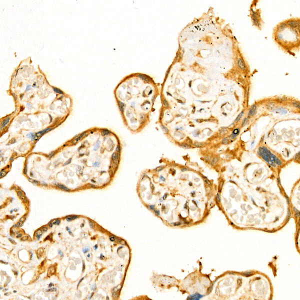 Bcl-XL Rabbit mAb