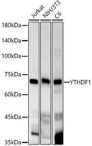 YTHDF1 Rabbit mAb