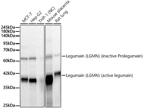 Legumain (LGMN) Rabbit mAb