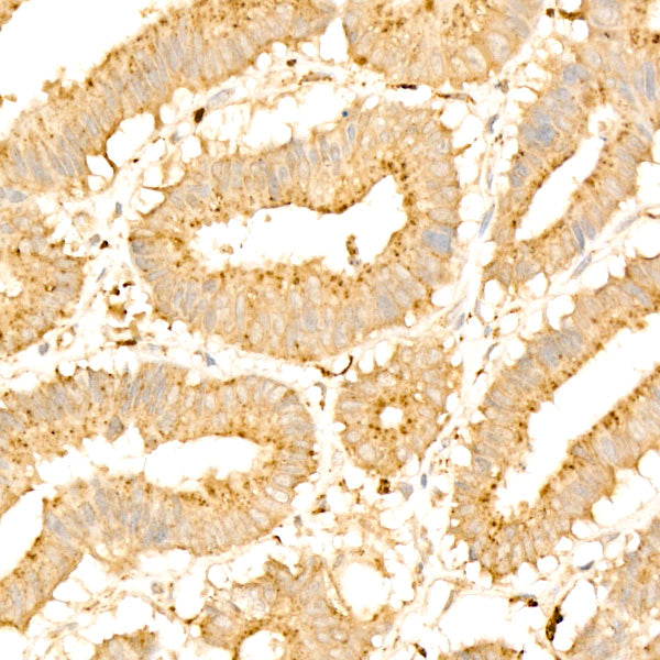 Legumain (LGMN) Rabbit mAb