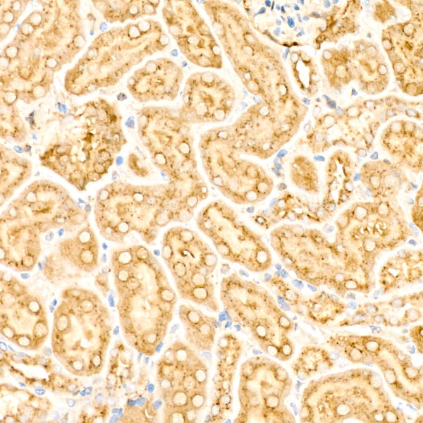 Legumain (LGMN) Rabbit mAb