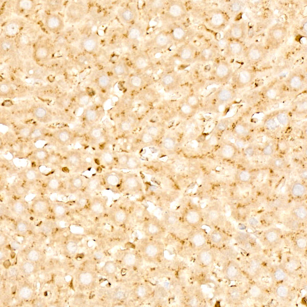 Legumain (LGMN) Rabbit mAb