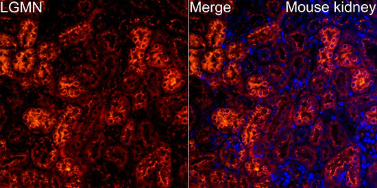 Legumain (LGMN) Rabbit mAb