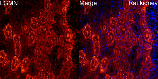 Legumain (LGMN) Rabbit mAb