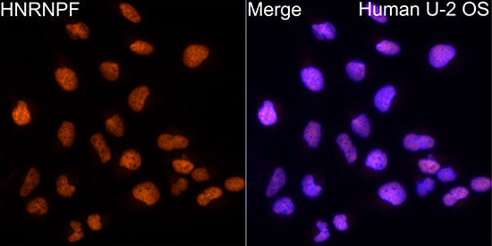 hnRNP F Rabbit mAb