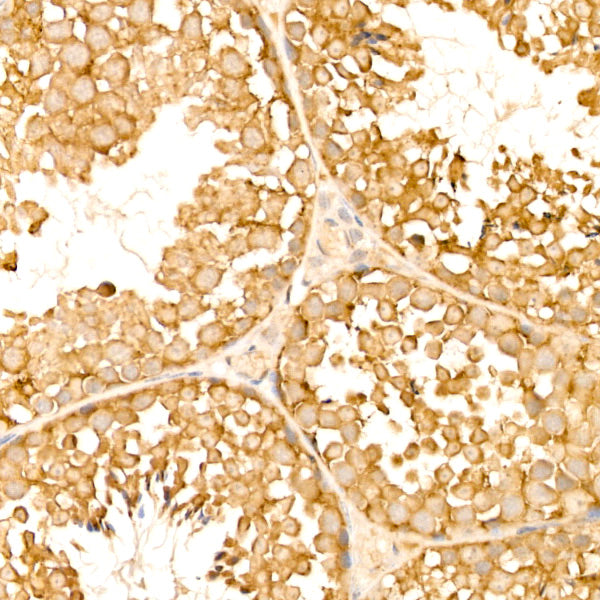 [KD Validated] TOLLIP Rabbit mAb