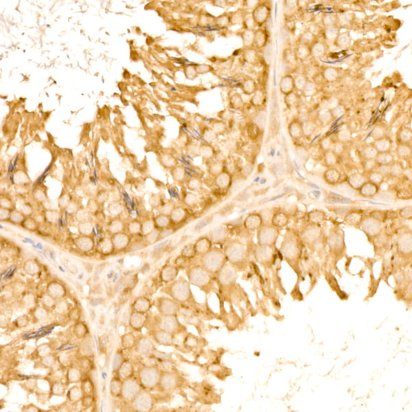 [KD Validated] TOLLIP Rabbit mAb