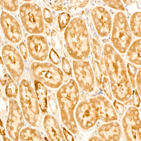 GABARAPL1 Rabbit mAb