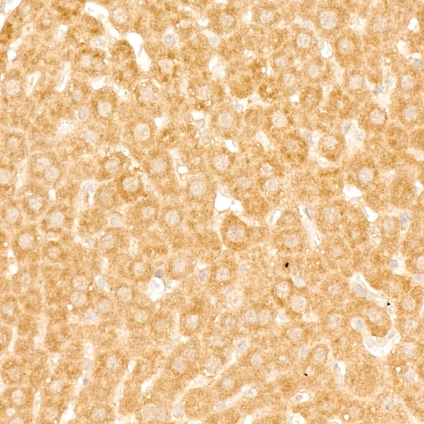 GABARAPL1 Rabbit mAb