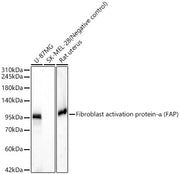 Fibroblast activation protein-α (FAP) Rabbit mAb